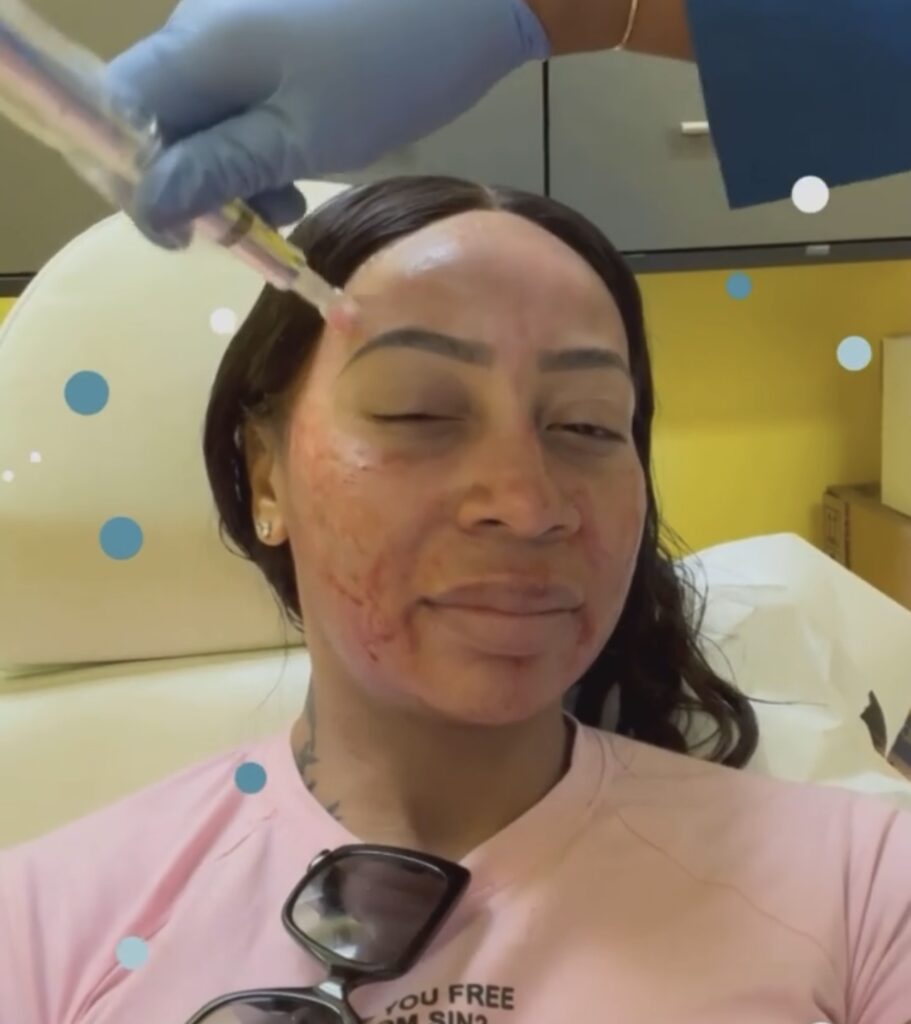 A woman getting her face waxed at the salon