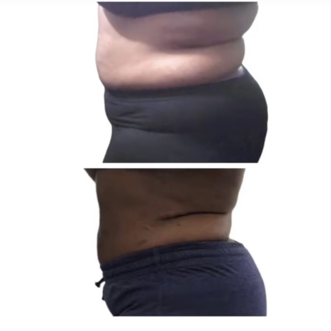 A before and after picture of the same person 's stomach.